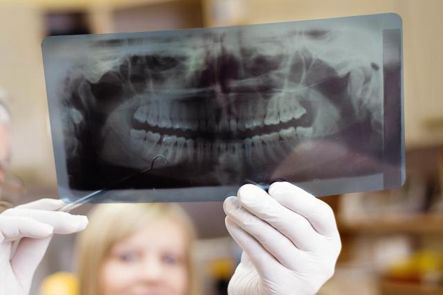 رشد مجدد دندان از طریق لیزر/ تکنولوژی روز